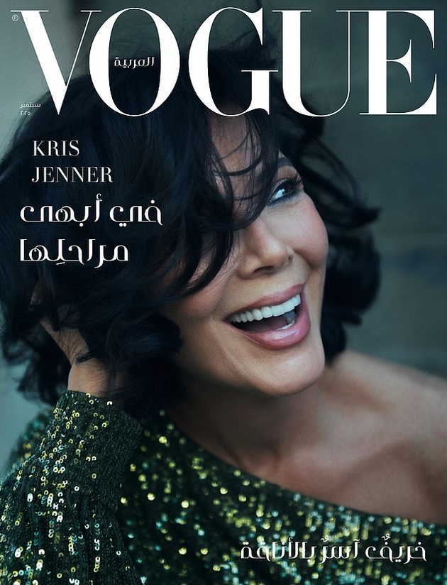 Kris Jenner: “Kjo është mënyra ime për t’u plakur me dinjitet” – 69-vjeçarja tregon për faceliftin $100,000 