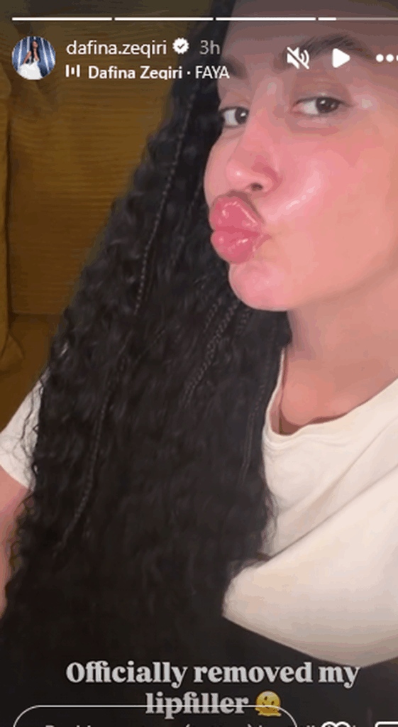 Dafina i bashkohet trendit të heqjes së fillerave