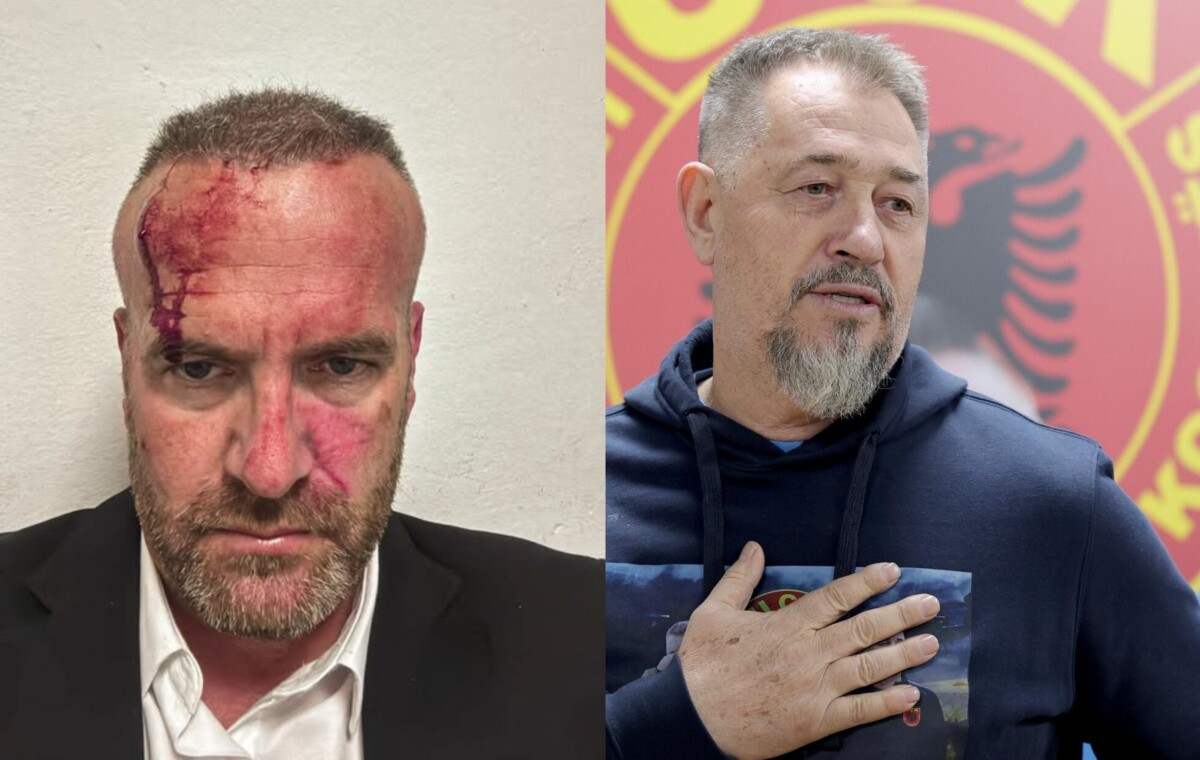 LVV ja akuzon Sami Lushtakun për sulm ndaj Hysni Mehanit  Lushtaku  Etiketat si  Sami Serbia  qytetarët nuk i tolerojnë