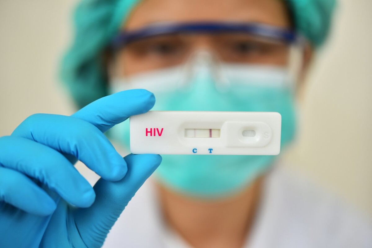 ne-maqedoni-gjate-muajit-korrik-jane-regjistruar-11-raste-te-reja-me-hiv-aids